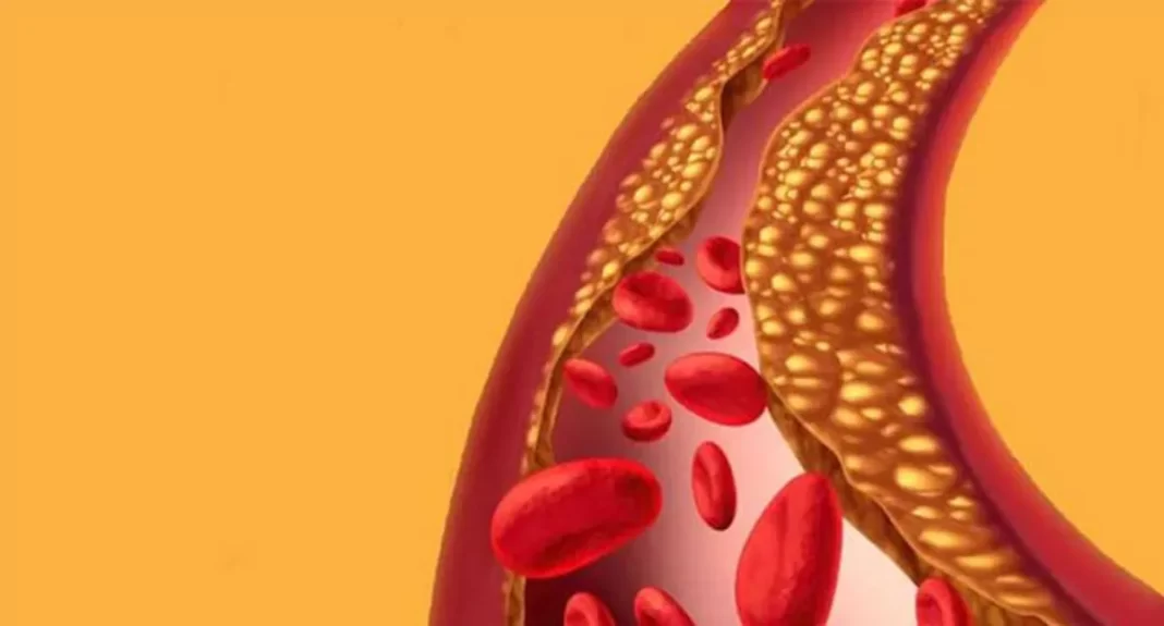 Increased Cholesterol? A Guide to Controlling Increased Cholesterol Levels