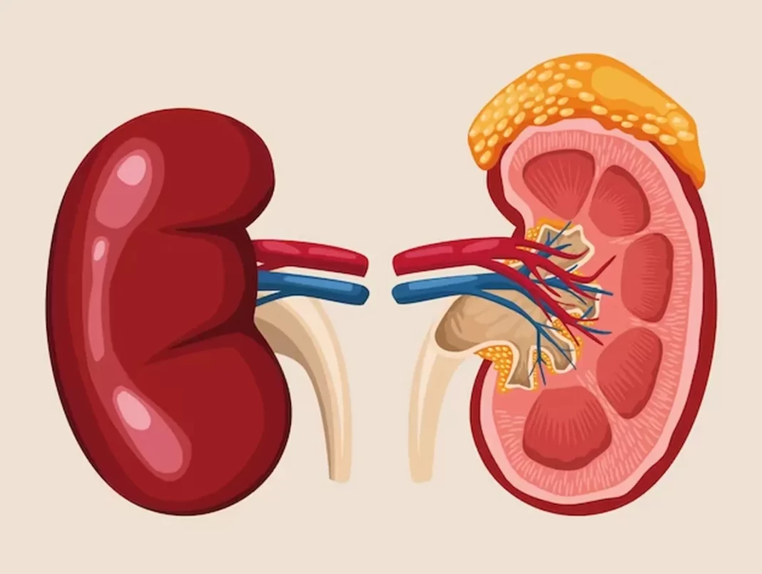 Silent Killer of Kidneys: 6 Beware of Prognosis